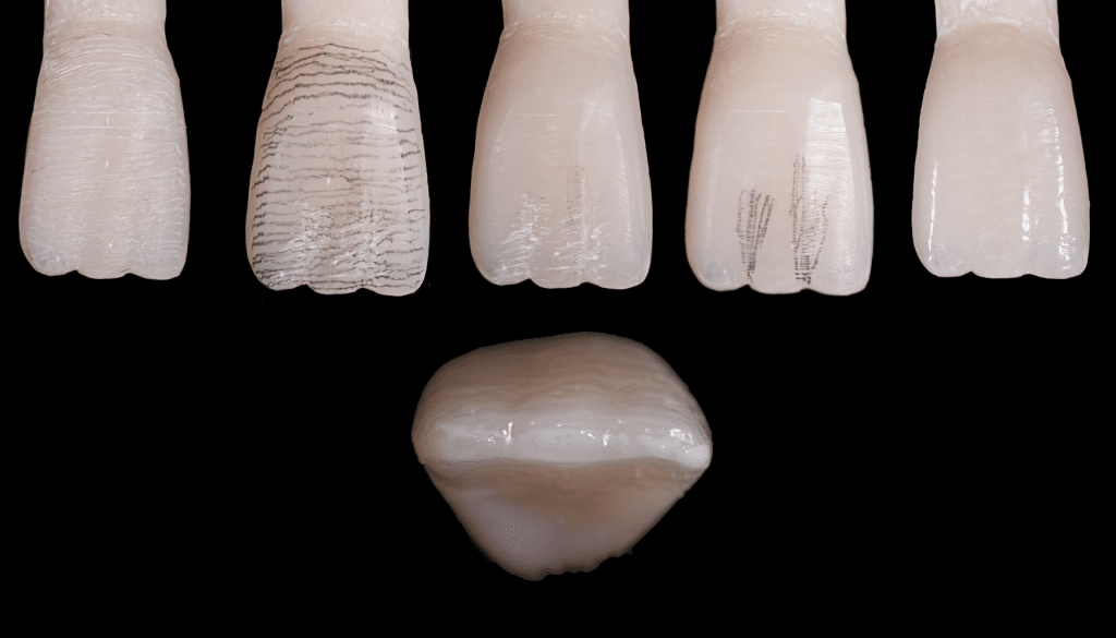 stratification composite
