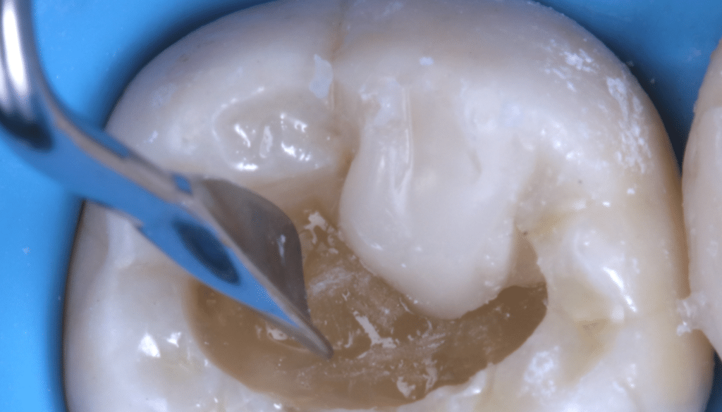Replica Posterior composite