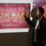 formation dentaire usures academie du sourire olivier etienne