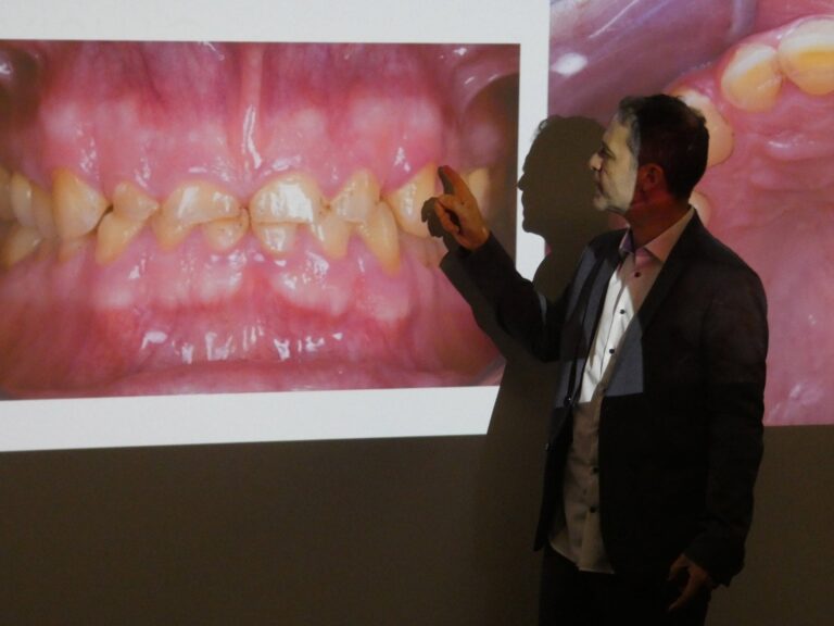formation dentaire usures academie du sourire olivier etienne