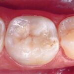 formation dentaire elearning dentistes