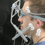 cursus occlusion