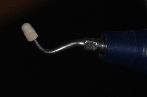 Joints de qualité collage inlays