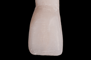 stratification composite