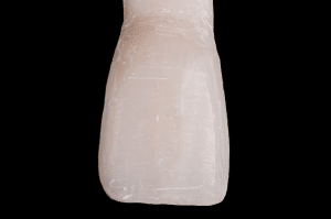 stratification composite