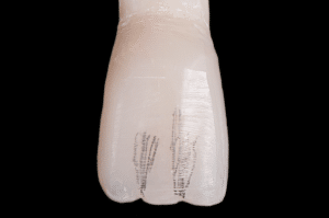 stratification composite