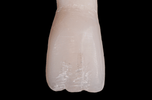 stratification composite