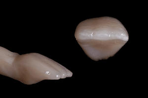 stratification composite