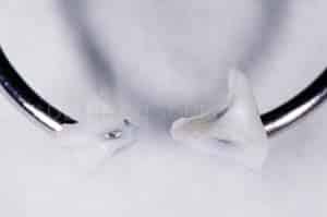 Anneau pour modifier point de contact dentaire