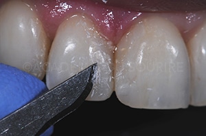 Finition composite