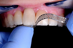 Finition composite