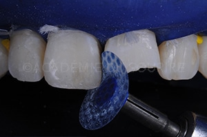 Finition composite