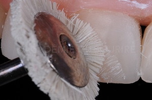 Finition composite