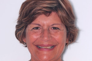 Sourire instantané