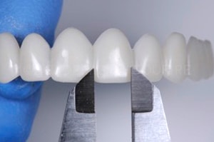 Sourire instantané