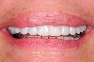 Sourire instantané