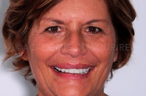 Sourire instantané