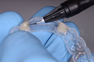 Gestion mucco gingivale intermediaire bridge
