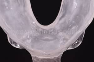Gestion mucco gingivale intermediaire bridge