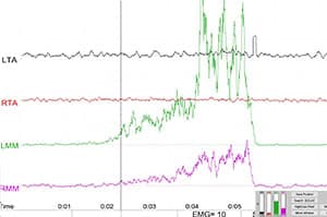 Vérifier occlusion dentaire