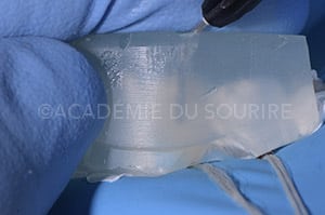 composite injecté clé silicone