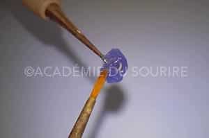 Stamp technique dent