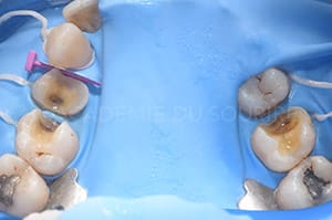 Empreinte sous digue CFAO