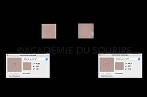 Relevé de couleur dentaire technique bouton