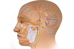 TENS neuromusculaire occlusion dentaire