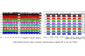 TENS neuromusculaire occlusion dentaire