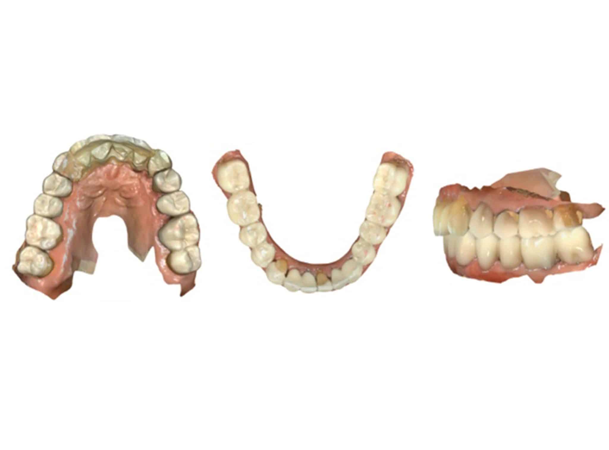 Flux numérique CFAO dentaire