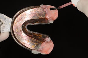 Porte empreinte dentaire