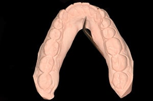 Porte empreinte dentaire