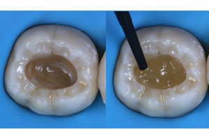 Replica Posterior composite
