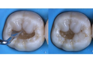 Replica Posterior composite
