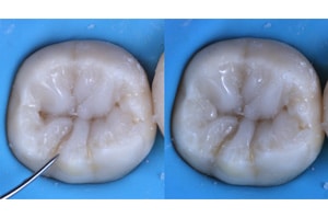 Replica Posterior composite