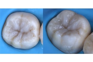 Replica Posterior composite
