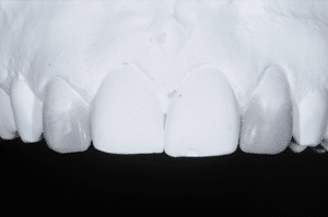 Canines position de latérales
