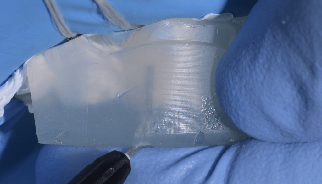 composite injecté clé silicone
