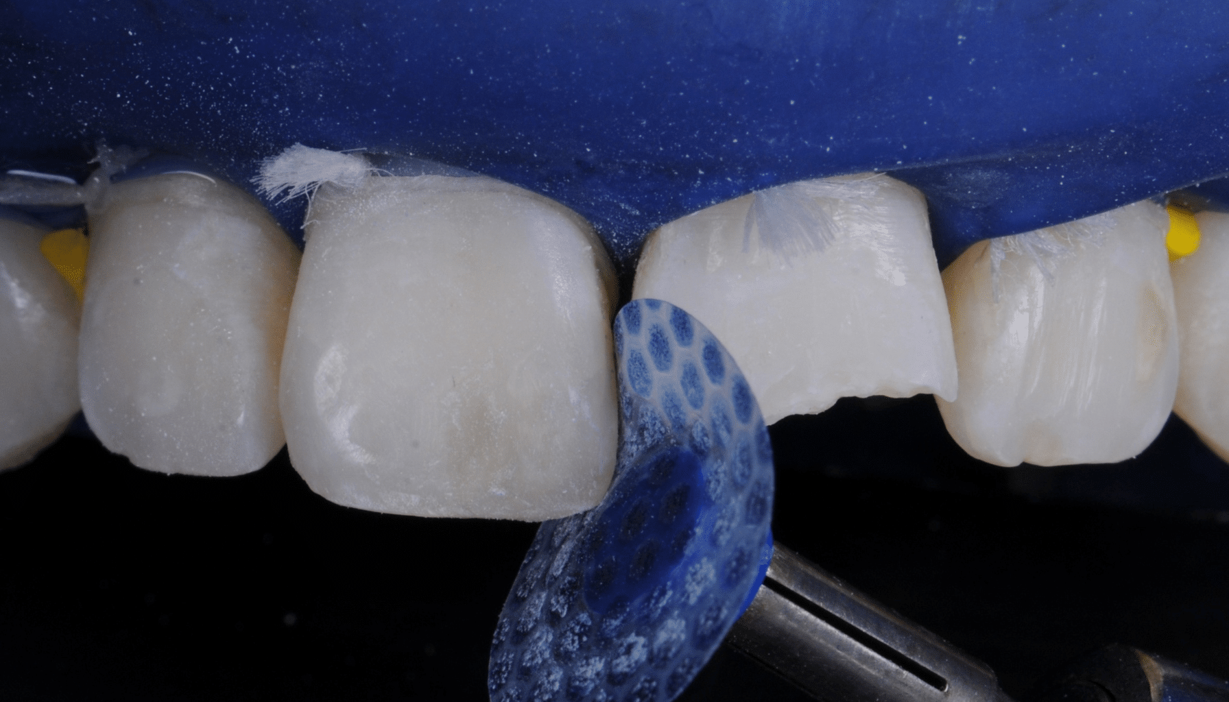 Finition composite