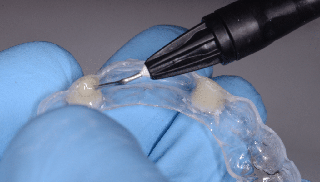 Gestion mucco gingivale intermediaire bridge