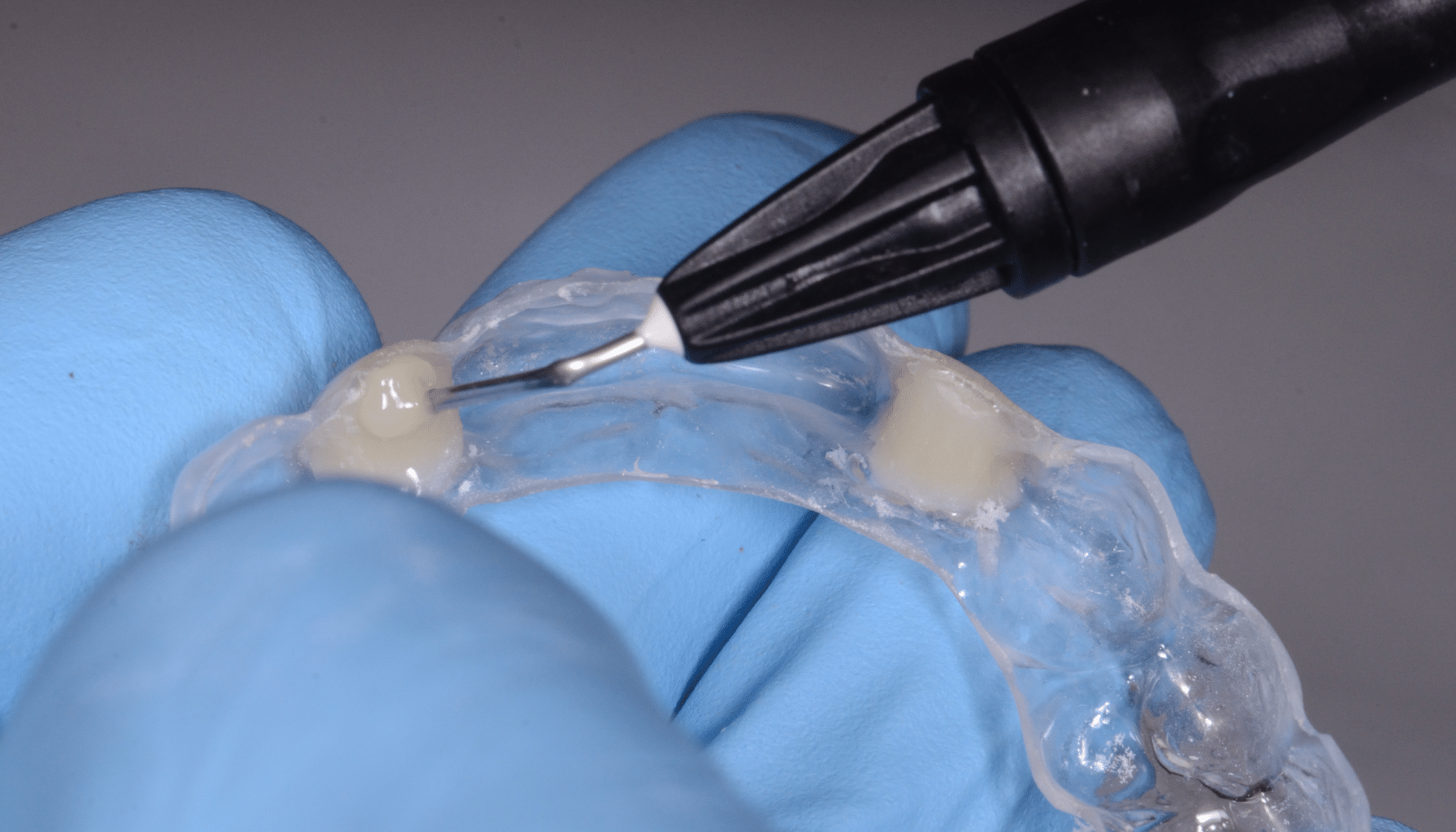 Gestion mucco gingivale intermediaire bridge