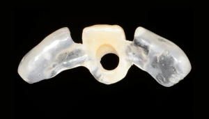 Guide chirurgical couronne provisoire