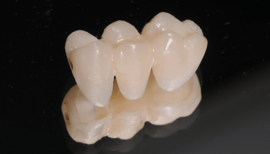 réaliser des provisoires dentaires brillants
