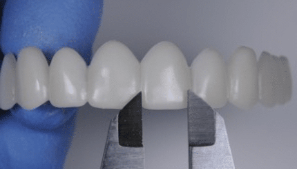 Sourire instantané