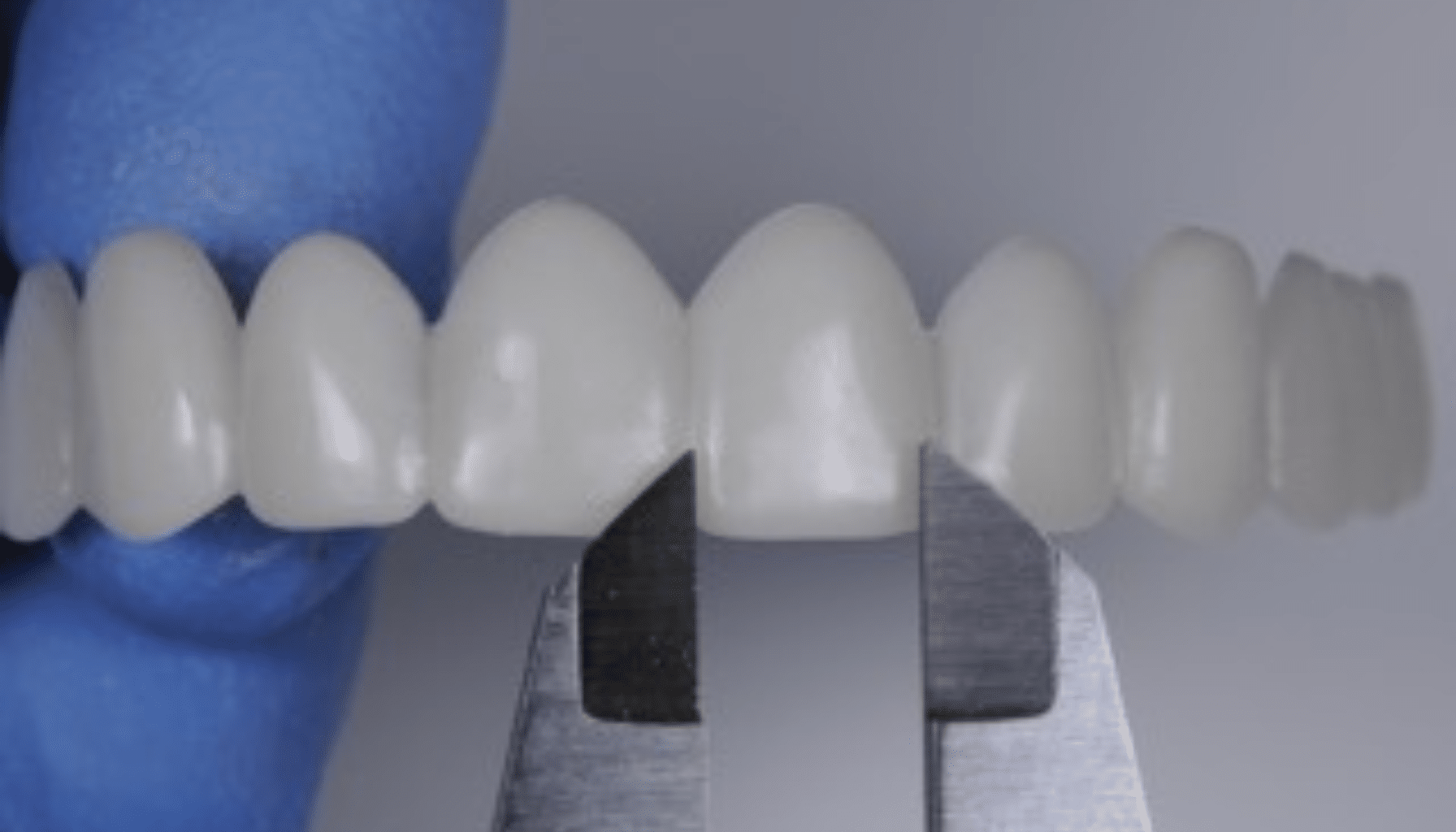 Sourire instantané