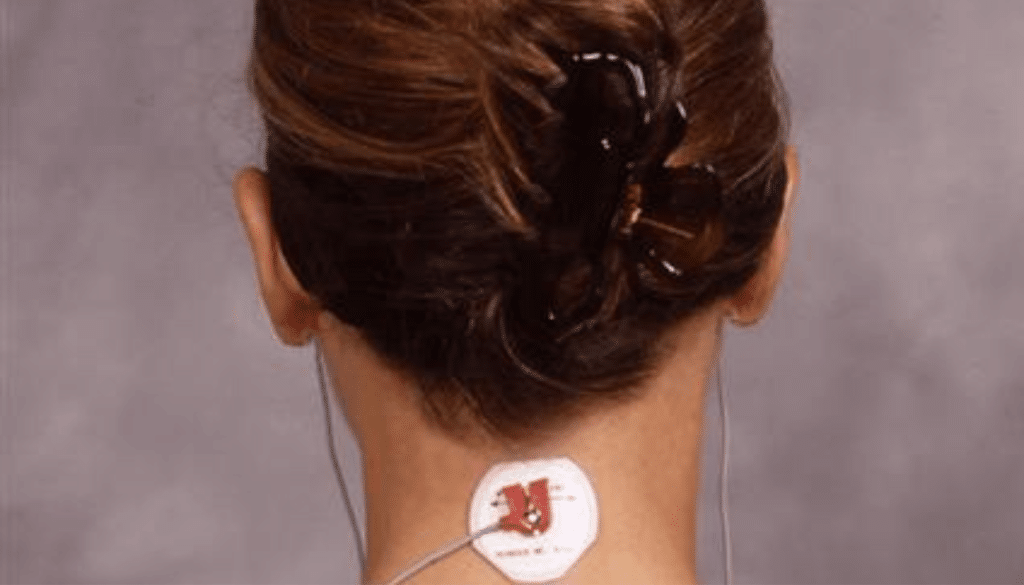 TENS neuromusculaire occlusion dentaire