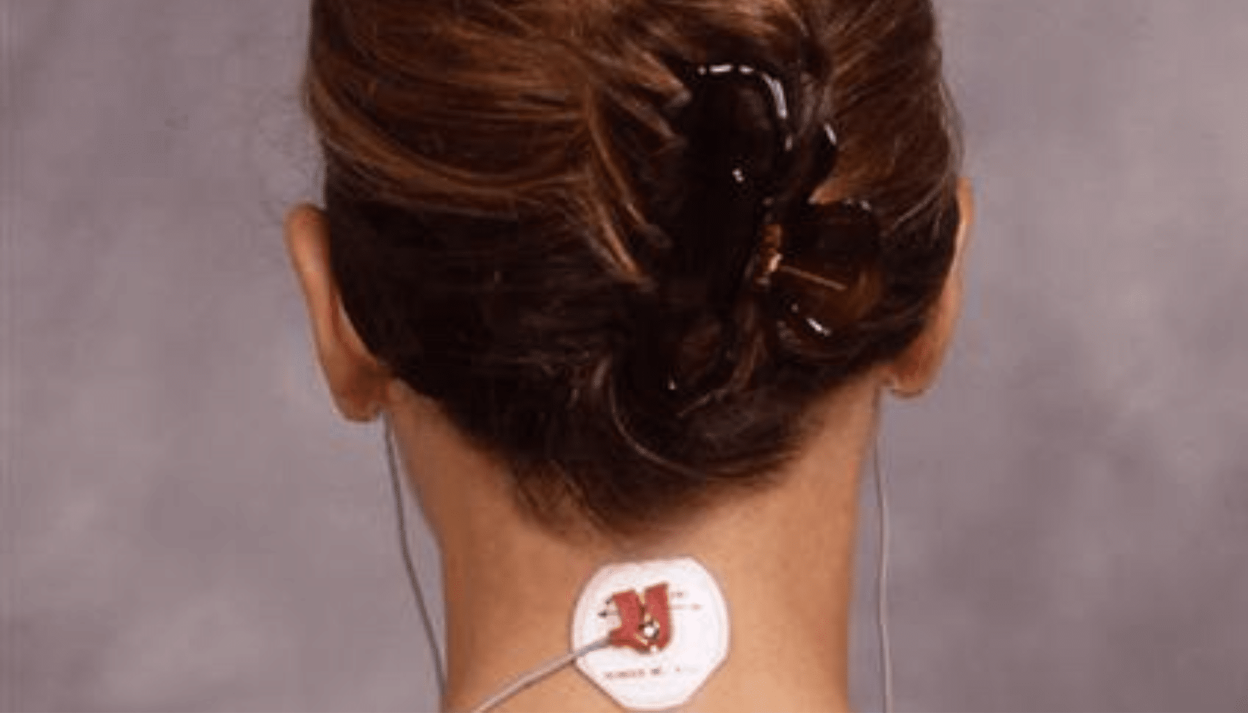 TENS neuromusculaire occlusion dentaire