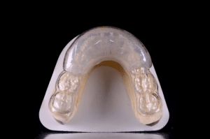Astuce précision résine composite 1