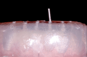 Astuce précision résine composite 5b